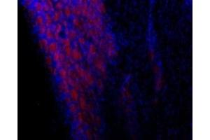 Immunohistochemistry (IHC) image for anti-Transient Receptor Potential Cation Channel, Subfamily C, Member 3 (TRPC3) (AA 822-835), (Intracellular) antibody (Atto 594) (ABIN7043819)