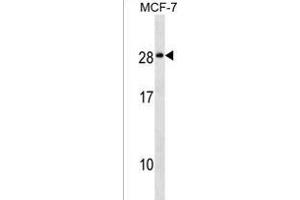 NKAI4 Antibody (C-term) (ABIN1536774 and ABIN2849663) western blot analysis in MCF-7 cell line lysates (35 μg/lane). (NKAIN4 抗体  (C-Term))