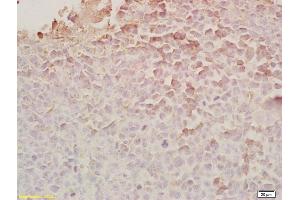 Formalin-fixed and paraffin embedded rat brain tissue labeled Anti-Chemerin/TIG2 Polyclonal Antibody, Unconjugated (ABIN687427) at 1:200, followed by conjugation to the secondary antibody and DAB staining (Chemerin 抗体  (AA 81-163))