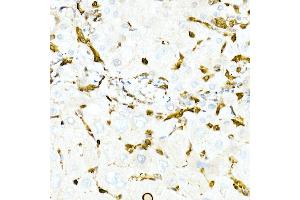 Immunohistochemistry of paraffin-embedded Human liver using GST3/GSTP1 antibody (ABIN7267448) at dilution of 1:100 (40x lens). (GSTP1 抗体)