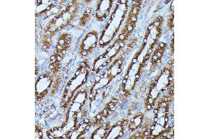 Immunohistochemistry of paraffin-embedded mouse kidney using FGD1 antibody (ABIN7267284) at dilution of 1:100 (40x lens). (FGD1 抗体  (AA 700-800))