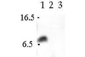 Western Blot analsyis using Cellubrevin antibody in Human CaCo-2 cell extract (Lane 1), Canine MDCK cell extract (Lane 2) and Rat PC12 cell extract.