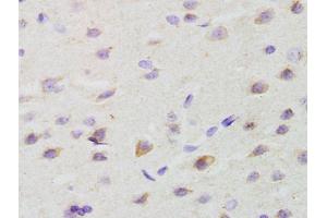Formalin-fixed and paraffin embedded rat brain labeled with Anti-GALR2 Polyclonal Antibody, Unconjugated (ABIN1386167) at 1:200 followed by conjugation to the secondary antibody and DAB staining (GALR2 抗体  (AA 51-150))