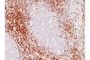 Formalin-fixed, paraffin-embedded human Tonsil stained with CD6 Monoclonal Antibody (C6/372+3F7B5). (CD6 抗体)