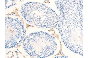Immunohistochemistry (IHC) image for anti-Receptor tyrosine-protein kinase erbB-2 (ErbB2/Her2) (pTyr877) antibody (ABIN6256054)