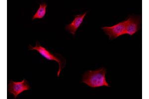 ABIN6257584 and ABIN6274265 staining Hela by IF/ICC. (CK1 epsilon 抗体  (Internal Region))