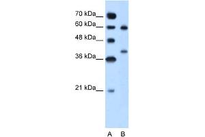 WB Suggested Anti-ARG1 Antibody Titration:  5. (Liver Arginase 抗体  (N-Term))
