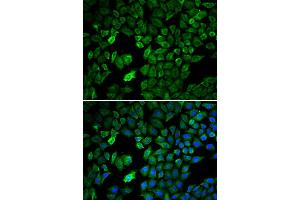 Immunofluorescence analysis of U2OS cell using PRMT5 antibody. (PRMT5 抗体)
