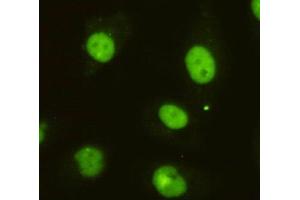 Immunocytochemistry of HeLa cells using anti-DBC1 mouse mAb diluted 1:200. (DBC1 抗体)