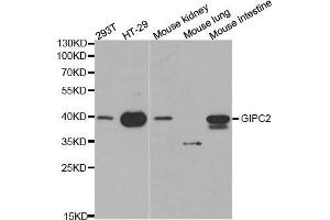 Western blot analysis of extracts of various cell lines, using GIPC2 antibody. (GIPC2 抗体  (AA 1-315))