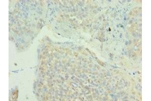 Immunohistochemistry of paraffin-embedded human tonsil tissue using ABIN7160003 at dilution of 1:100 (MAPK4 抗体  (AA 348-587))