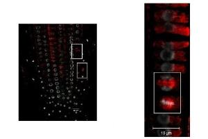 Immunohistochemistry (IHC) image for anti-Tubulin alpha Chain (TUB1) antibody (ABIN7477855) (Tubulin alpha Chain (TUB1) 抗体)