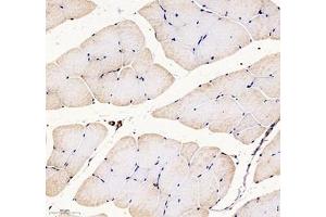 Immunohistochemistry (Paraffin-embedded Sections) (IHC (p)) image for anti-Palladin, Cytoskeletal Associated Protein (PALLD) antibody (ABIN7074976)