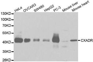Western blot analysis of extracts of various cell lines, using CXADR antibody. (Coxsackie Adenovirus Receptor 抗体  (AA 20-237))