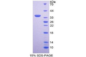 SDS-PAGE (SDS) image for Cyclin D3 (CCND3) (AA 1-292) protein (His tag) (ABIN2124527) (Cyclin D3 Protein (CCND3) (AA 1-292) (His tag))