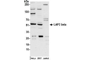 Western Blotting (WB) image for anti-LAP2 beta/tmpo (AA 300-350) antibody (ABIN7455056) (LAP2 beta/tmpo (AA 300-350) 抗体)