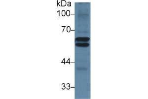 Western Blotting (WB) image for anti-Lecithin-Cholesterol Acyltransferase (LCAT) (AA 290-432) antibody (ABIN7438331)