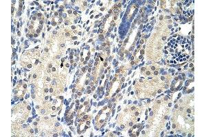 EIF4E2 antibody was used for immunohistochemistry at a concentration of 4-8 ug/ml to stain Epithelial cells of renal tubule (arrows) in Human Kidney. (EIF4E2 抗体  (N-Term))