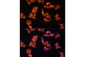 Immunofluorescence analysis of mouse heart using OBSCN antibody (ABIN7269076) at dilution of 1:100. (Obscurin 抗体)