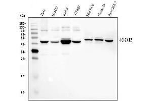 anti-Ribonucleotide Reductase M2 (RRM2) (AA 1-33), (N-Term) antibody