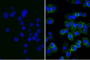 Human pancreatic carcinoma cell line MIA PaCa-2 was stained with Mouse Anti-Human CD44-UNLB and DAPI. (兔 anti-小鼠 IgG (Heavy & Light Chain) Antibody (FITC))