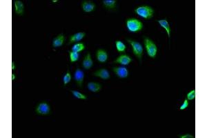 Immunofluorescence staining of A549 cells with ABIN7151424 at 1:166, counter-stained with DAPI. (EFHD1 抗体  (AA 15-72))