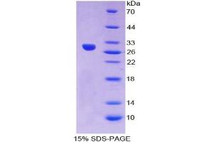 SDS-PAGE analysis of Human Crystallin lambda 1 Protein. (CRYL1 蛋白)