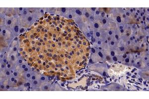 Detection of CBX3 in Mouse Pancreas Tissue using Polyclonal Antibody to Chromobox Homolog 3 (CBX3) (CBX3 抗体  (AA 1-183))