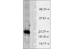 Image no. 2 for anti-Superoxide Dismutase 1, Soluble (SOD1) antibody (ABIN264856) (SOD1 抗体)