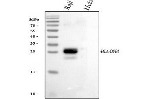 Western blot analysis of HLA-DPB1 using anti-HLA-DPB1 antibody (ABIN4886618).