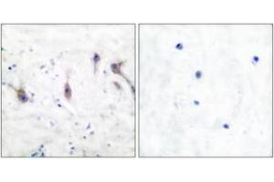 Immunohistochemistry analysis of paraffin-embedded human brain tissue, using ARC Antibody. (ARC (AA 159-208) 抗体)