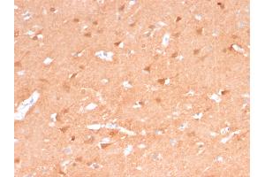 ABIN6383833 to UCHL1 was successfully used to stain neuronal cell bodies in human cerebellum sections.