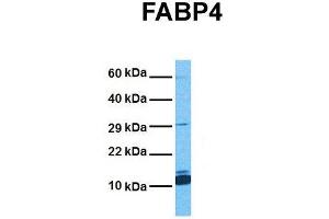 Host:  Rabbit  Target Name:  FABP4  Sample Tissue:  Human Stomach Tumor  Antibody Dilution:  1.