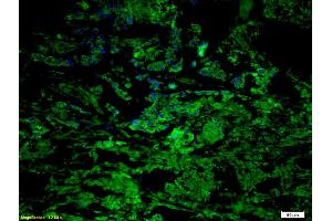 Immunofluorescence (IF) image for anti-Chemokine (C-C Motif) Receptor 7 (CCR7) (AA 25-59) antibody (ABIN674724)