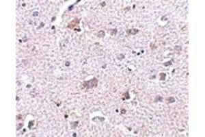 Immunohistochemistry (IHC) image for anti-Cerebral Dopamine Neurotrophic Factor (CDNF) (C-Term) antibody (ABIN1030330) (CDNF 抗体  (C-Term))