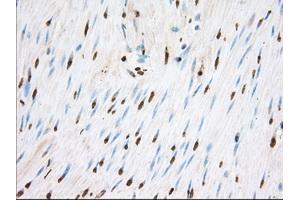 Image no. 1 for anti-Transforming, Acidic Coiled-Coil Containing Protein 3 (TACC3) antibody (ABIN1498097) (TACC3 抗体)
