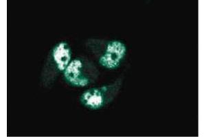 Immunofluorescence staining of AN3 CA cells (Human endometrial adenocarcinoma, ATCC HTB-111). (PCNA 抗体  (AA 68-230))