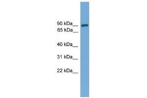 Western Blot showing DEPDC1 antibody used at a concentration of 1-2 ug/ml to detect its target protein. (DEPDC1 抗体  (Middle Region))
