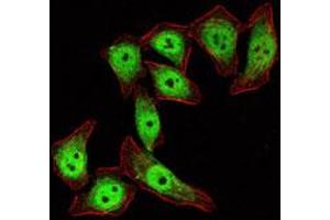 Immunofluorescence analysis of Eca-109 cells using KLF4 monoclonal antibody, clone 1E6  (green) . (KLF4 抗体)