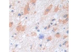 IHC-P analysis of Human Tissue, with DAB staining. (CPE 抗体  (AA 318-476))