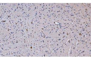 IHC analysis of GLS using anti-GLS antibody (ABIN7601603).
