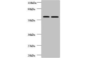 Western blot All lanes: FUCA2 antibody at 2 μg/mL Lane 1: EC109 whole cell lysate Lane 2: 293T whole cell lysate Secondary Goat polyclonal to rabbit IgG at 1/10000 dilution Predicted band size: 55, 20 kDa Observed band size: 55 kDa (FUCA2 抗体  (AA 29-465))