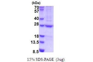 SDS-PAGE (SDS) image for N-6 Adenine-Specific DNA Methyltransferase 1 (Putative) (N6AMT1) (AA 1-214) protein (His tag) (ABIN6387504)