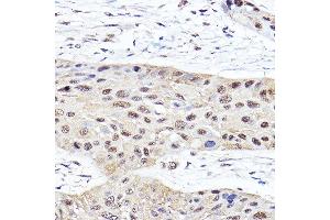 Immunohistochemistry (IHC) image for anti-Proteasome (Prosome, Macropain) Subunit, beta Type 2 (PSMB2) (AA 1-201) antibody (ABIN6146314)