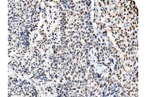 IHC analysis of DBC-1/CCAR2 using anti-DBC-1/CCAR2 antibody (ABIN7602235). (CCAR2 抗体  (AA 65-917))