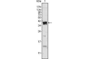 Western blot analysis using Androgen receptor mouse mAb against human recombinant Androgen receptor. (Androgen Receptor 抗体)