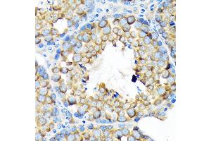Immunohistochemistry of paraffin-embedded mouse testis using  Rabbit mAb (ABIN7265532) at dilution of 1:100 (40x lens). (ALDH1A2 抗体)