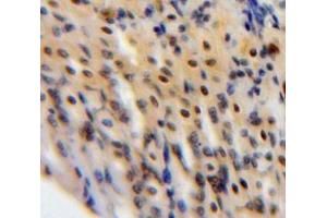 Immunohistochemistry (IHC) image for anti-Signal Transducer and Activator of Transcription 3 (Acute-Phase Response Factor) (STAT3) (AA 656-768) antibody (ABIN7443812)