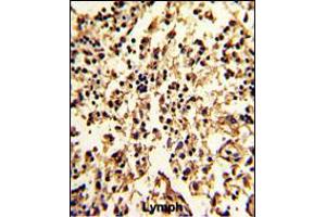 Immunohistochemistry (IHC) image for anti-serpin Peptidase Inhibitor, Clade A (Alpha-1 Antiproteinase, Antitrypsin), Member 9 (SERPINA9) (AA 194-222) antibody (ABIN5535094)