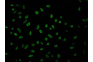 Immunofluorescence staining of Hela Cells with ABIN7127514 at 1:50, counter-stained with DAPI. (Recombinant Geminin 抗体)